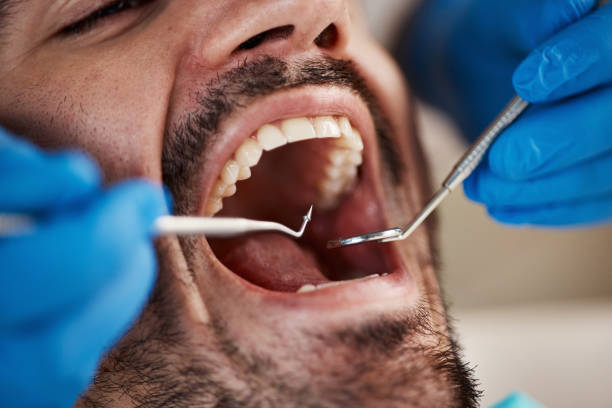 Best Walk-In Emergency Dentist in South Lockport, NY