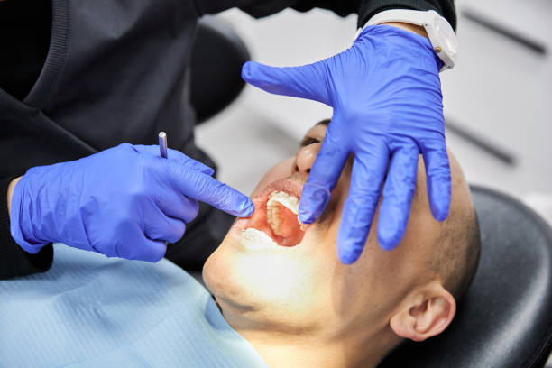 Best Emergency Tooth Extraction in South Lockport, NY
